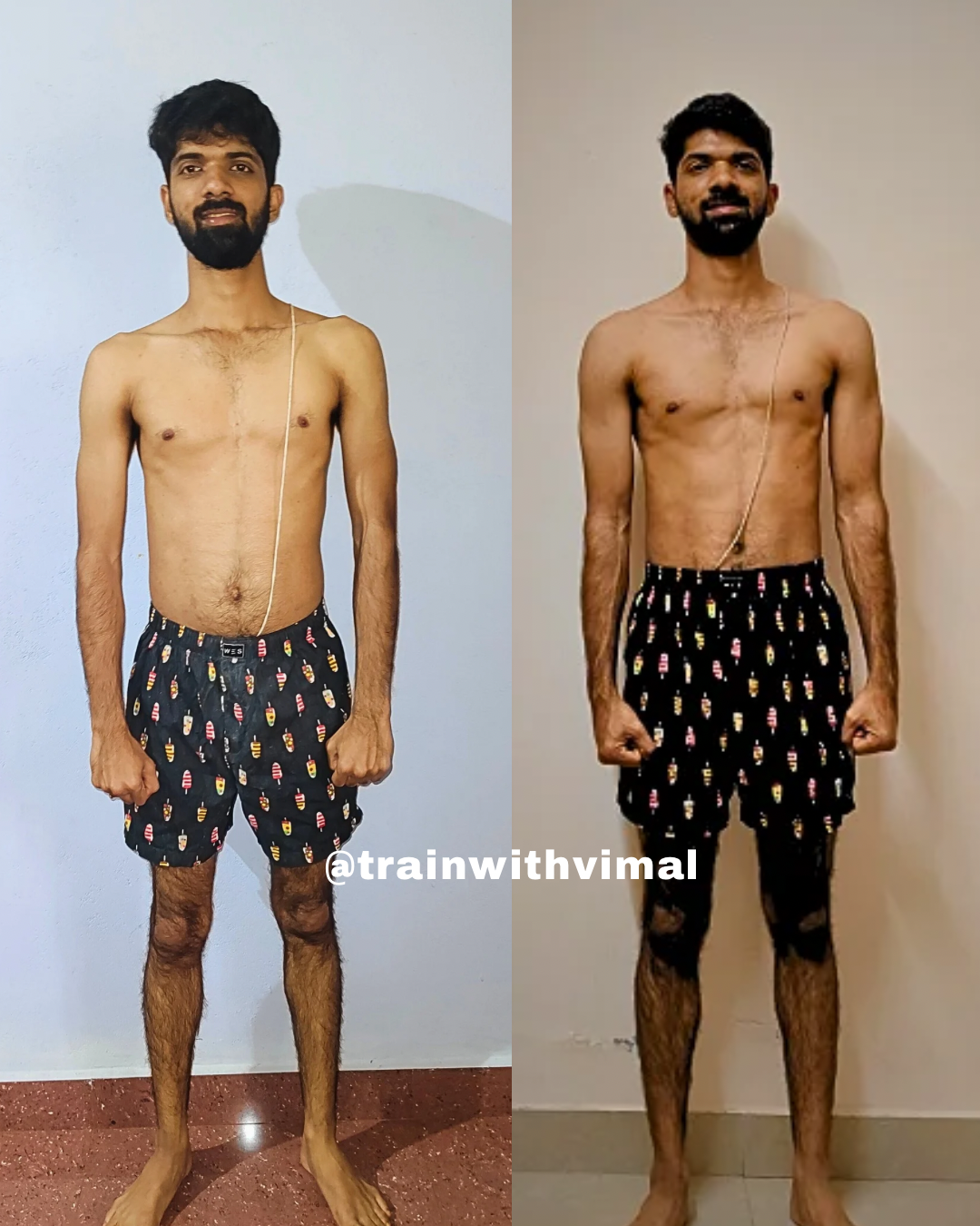 Pure Veg Gained 5+ Kgs in Just 12 Weeks while dealing with hyperthyroidism issue