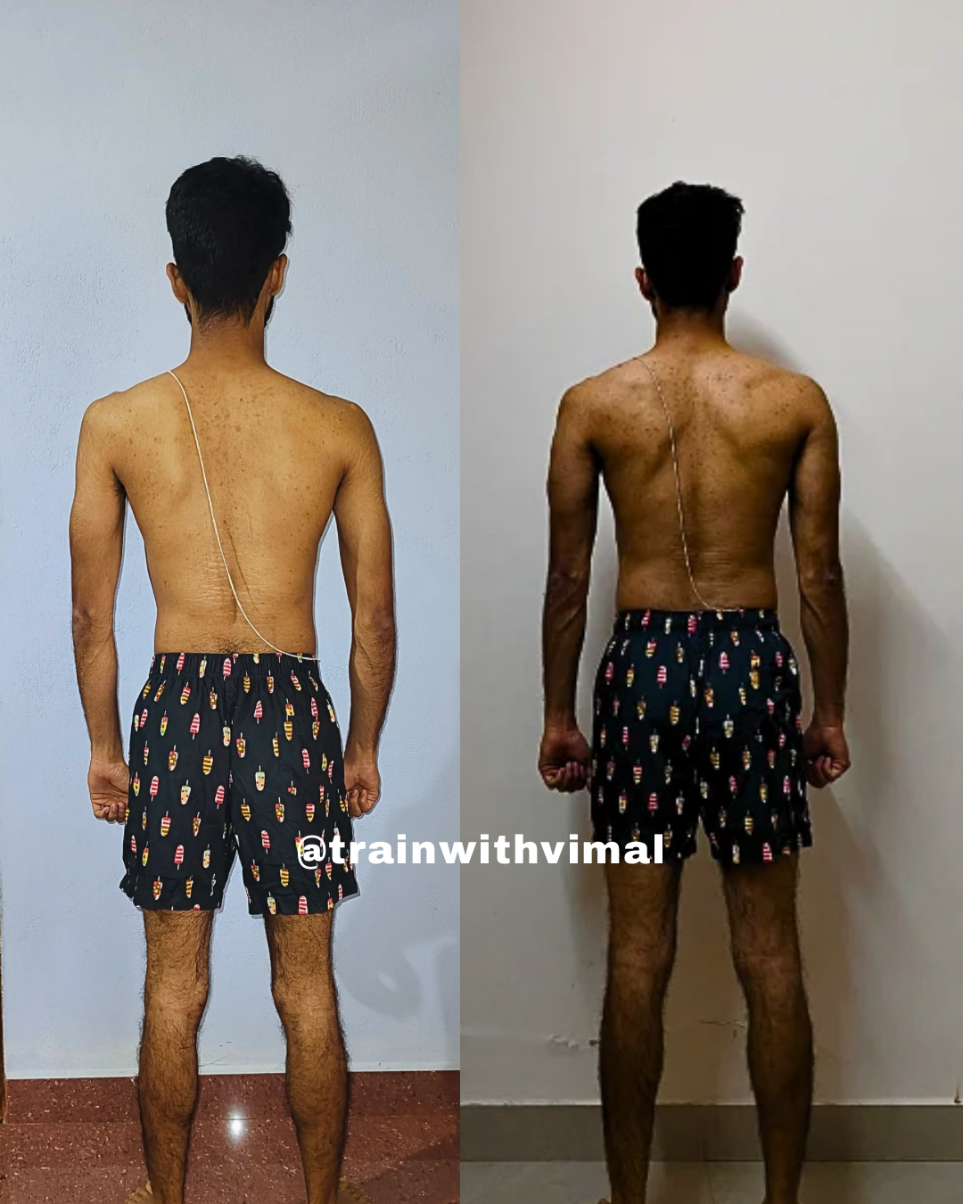 Pure Veg Gained 5+ Kgs in Just 12 Weeks while dealing with hyperthyroidism issue